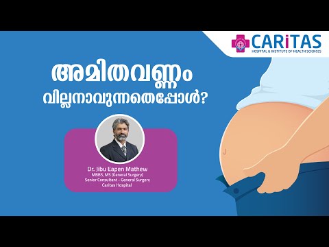 Obesity: A Villain in Disguise | Obesity Care | Caritas Hospital Kottayam