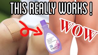 USE NAIL POLISH TO REMOVE BAND-AID RESIDUE