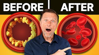 #1 BEST Meal to Prevent a Heart Attack and Stroke