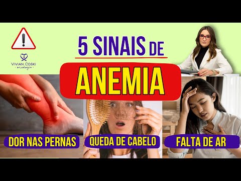 5 signs of anemia!