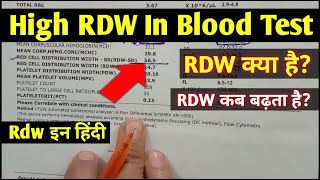 Rdw blood test hindi || High RDW  In Blood Test || Rdw test means || Rdw test report