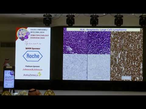 01 Role of CD30 in hematolymphoid malignancies | Dr. Saeed Alshieban | 26 Oct 2024