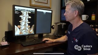 Newswise:Video Embedded a-broken-spine-gone-undetected