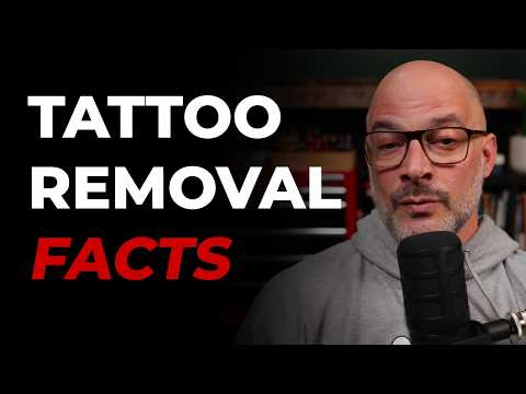 Tattoo Removal Facts