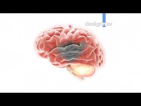 Cerevate medical animation