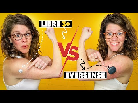 I Got the 365-Day Eversense Implantable CGM — Here’s What Week 1 Was REALLY Like!