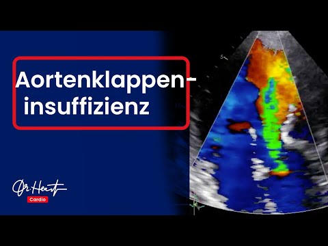 Seit mehreren Jahren leidet hypertensive Diuretika für Bluthochdruck und Diabetes
