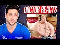 The Harsh Reality Of Being 800 Pounds Doctor Reacts