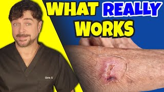 Stop Skin Tears And Bruises With This Simple Trick