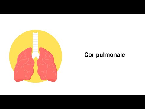 Hypertension Schritt 1 b Blutdruck und Spin
