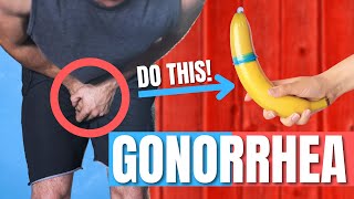 Everything you need to know on Gonorrhea! - Doctor Explains