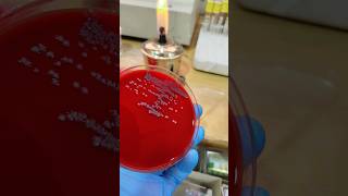 Microbial Growth | How to Count Colony Forming Units | #microbiology#bacteria #lab #clinical#medical