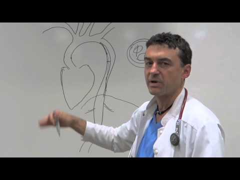 Аортна дисекация Аортна дисекация