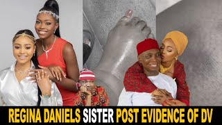 Regina Daniels Sister Post Evidence Of Alleged Domestic Vi0lence Against Ned Nwoko