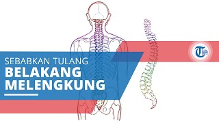 Lordosis, Kelainan Tulang yang Menyebabkan Penderitanya Memiliki Tulang Belakang Melengkung ke Dalam