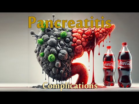 Pancreatitis Complications & Chronic Panc [Critical Care] | Part 03/03 | GI Series [Recorded Live!]