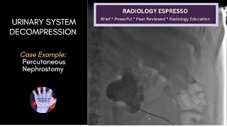 URINARY SYSTEM DECOMPRESSION - Case Example - PERCUTANEOUS NEPHROSTOMY TUBE PLACEMENT