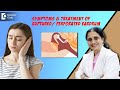 Perforated/Ruptured Eardrum -Causes & Treatment|Hole in the Ear -Dr.P Lakshmi Satish|Doctors' Circle