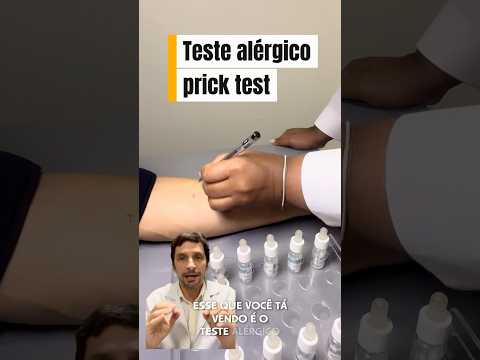 Allergy test (prick test). How is it done? #allergy #rhinitis #allergicrhinitis #asthma #dermatitis