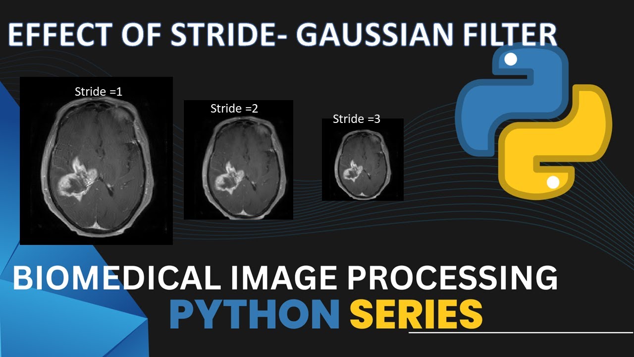Stride effect Gaussian filter | Code implementation | Biomedical Image Processing