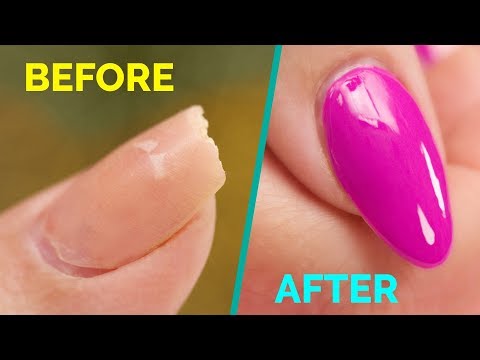 How to Fix A Broken Nail Fast!