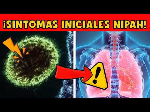 ¡ALERTA! VIRUS DE NIPAH NO ES UN VIRUS NUEVO!!!