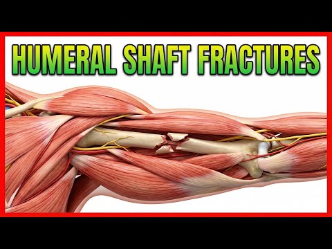 Humeral Shaft Fractures: Orthopedics Lectures
