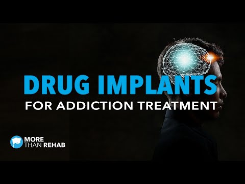 Drug Implants For Addiction Treatment | More Than Rehab | Houston, Texas Area Drug Rehabilitation