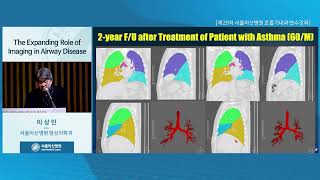 제28차 서울아산병원 호흡기내과 연수강좌 [Beyond PFT: New Horizons in Airway Assessment] : The Expanding Role of Imaging in Airway Disease 미리보기