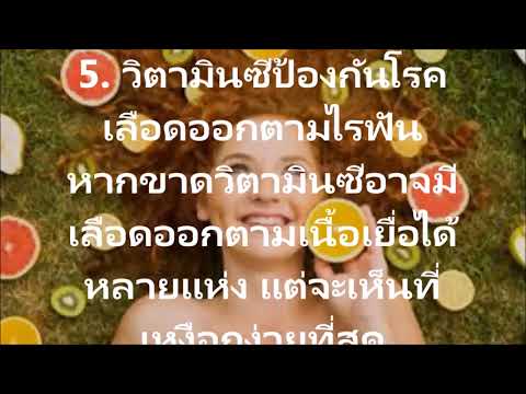 นักแสดงและโรคสะเก็ดเงิน แอปพลิเคโรคสะเก็ดเงิน mumie