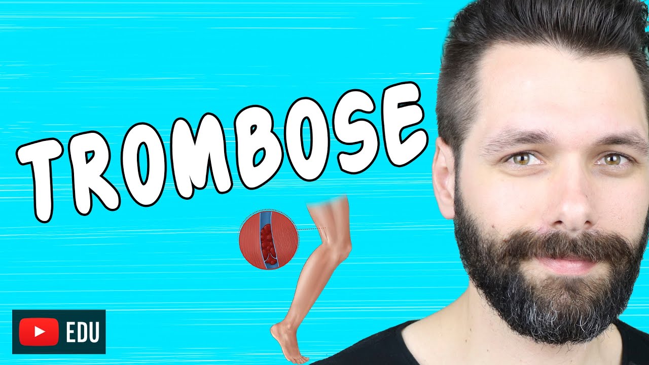 TROMBOSE - O que é, tipos, causas e sintomas | Biologia com Samuel Cunha