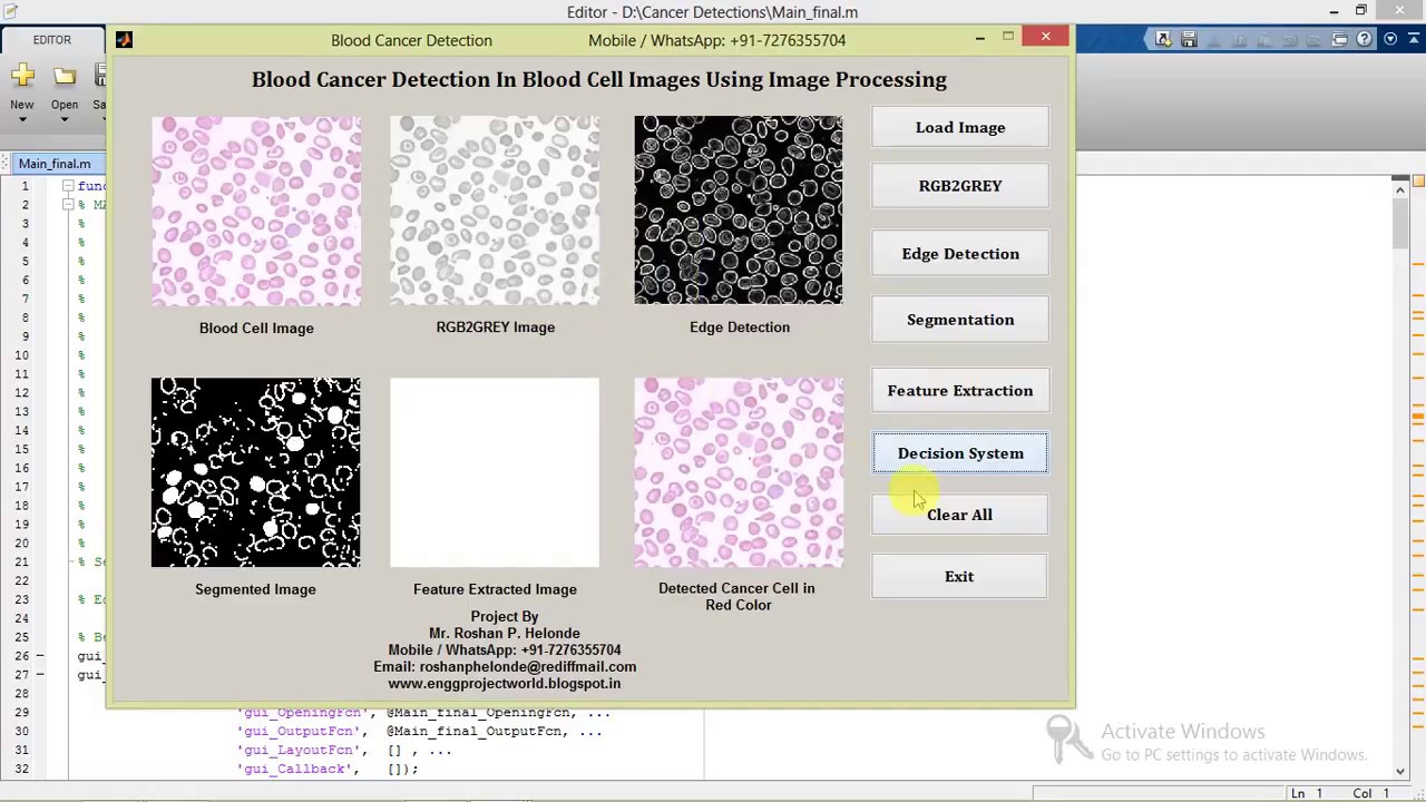 Leukemia (Blood) Cancer Detection Using Image Processing Matlab Project with Source Code