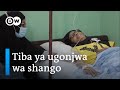 Fahamu Ugonjwa Wa Shango Na Tiba Yake