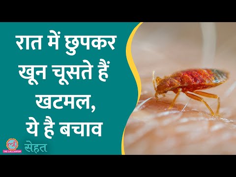 Bed Bugs यानी खटमलों ने मचा रखा है घर में आतंक? जानिए इनके काटने पर क्या करना चाहिए? | Sehat ep 745