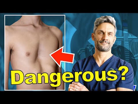 Pectus Excavatum - More Common than you Think!