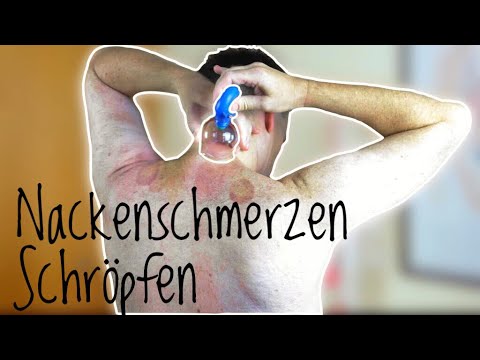 Wunder Hals nach dem Schlafen nicht schlucken kann Myositis Nacken Symptome und Behandlung
