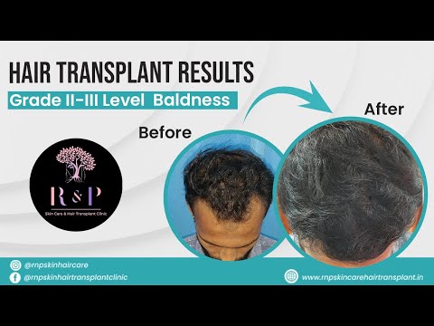 Patient result video thumbnail