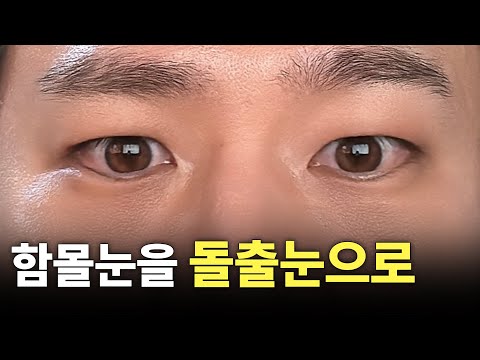 男性眼部 02