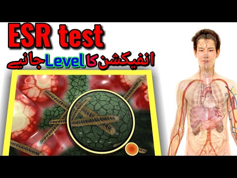 esercizi per la prostatite test online