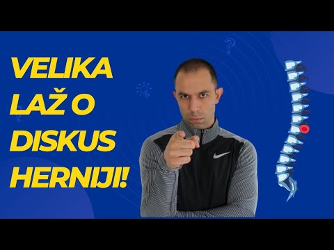 Iscurio diks? Diskus hernija? VELIKA LAŽ za koju niste znali!