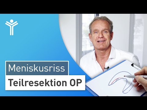 Meniskus OP: Meniskusriss arthroskopisch behandeln | Teilresektion