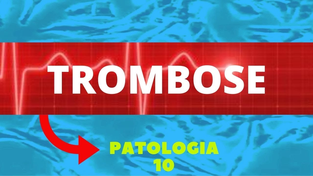TROMBOSE - PATOLOGIA - AULA 10