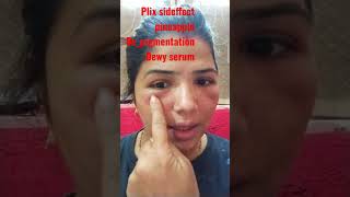 #sideffects #plix pigmentation serum #online products#chetna rohit world YouTube par #sidefect full