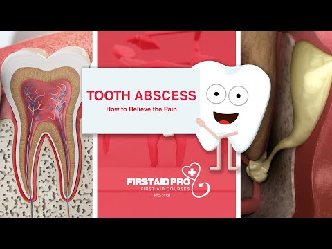 How to relieve a tooth abscess