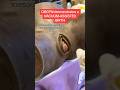 OBGYN Shows Vacuum Assisted Birth Shorts