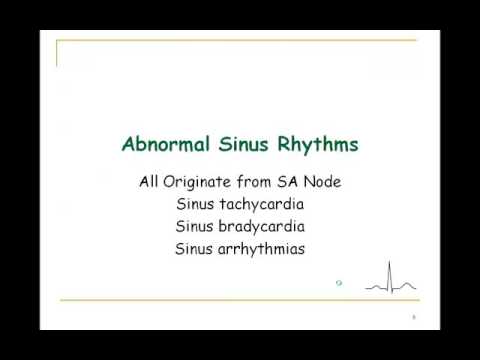 Cardiac Arrhythmias