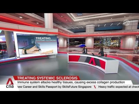 Systemic sclerosis causes 1 in 2 deaths within 4 years of diagnosis