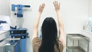 二の腕と肩の脂肪吸引、翌日の様子