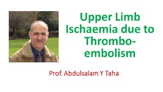 Upper Limb Ischaemia due to Thrombo-embolism