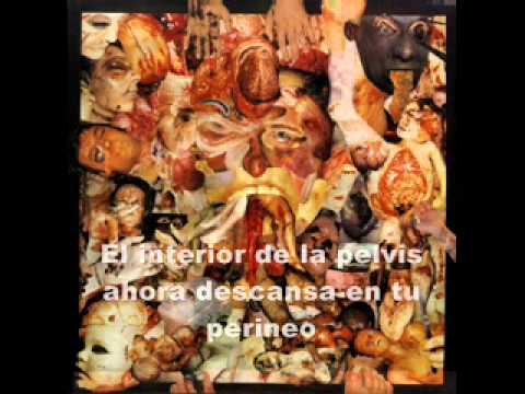 Carcass - Splattered cavities (subtitulado en español)